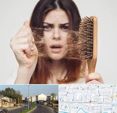 دکتر ریزش مو در ضیابری رشت