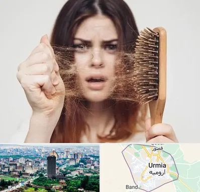 دکتر ریزش مو در ارومیه