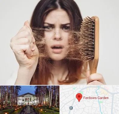 دکتر ریزش مو در باغ فردوس