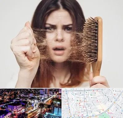 دکتر ریزش مو در منظریه رشت