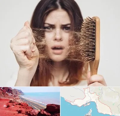 دکتر ریزش مو در هرمزگان