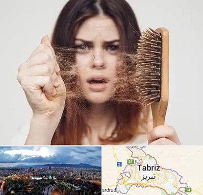 دکتر ریزش مو در تبریز