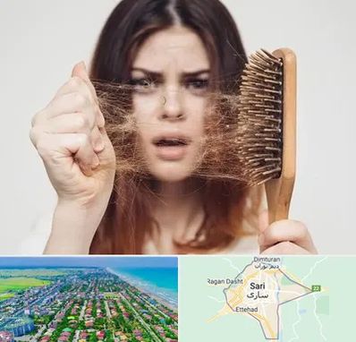 دکتر ریزش مو در ساری
