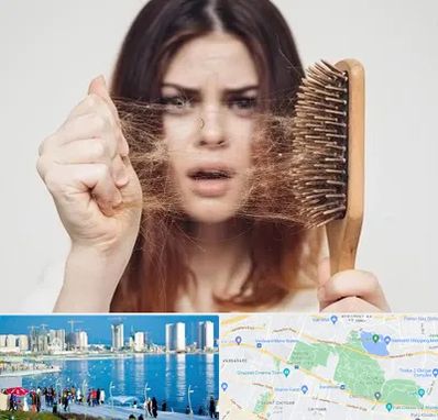 دکتر ریزش مو در چیتگر 