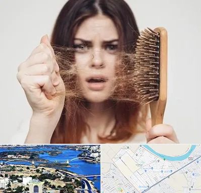 دکتر ریزش مو در کوروش اهواز