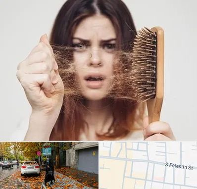 دکتر ریزش مو در خیابان فلسطین