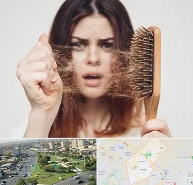 دکتر ریزش مو در کمال شهر کرج