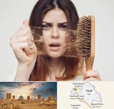دکتر ریزش مو در یزد