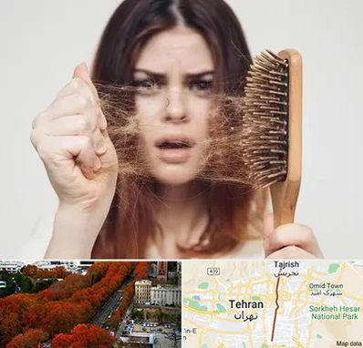 دکتر ریزش مو در ولیعصر 