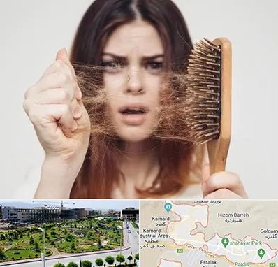 دکتر ریزش مو در پردیس