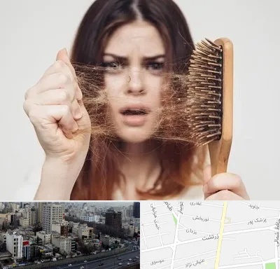 دکتر ریزش مو در زرتشت