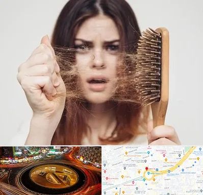 دکتر ریزش مو در میدان ولیعصر 