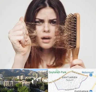 دکتر ریزش مو در اختیاریه 