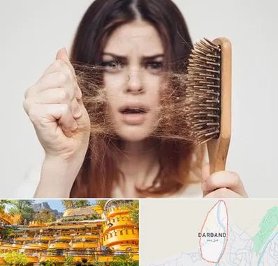 دکتر ریزش مو در دربند