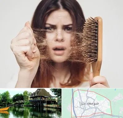 دکتر ریزش مو در صومعه سرا