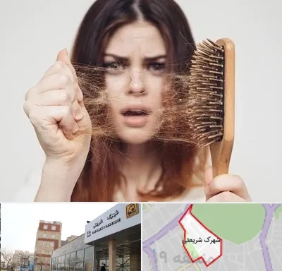دکتر ریزش مو در شهرک شریعتی