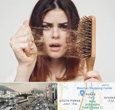 دکتر ریزش مو در پونک 