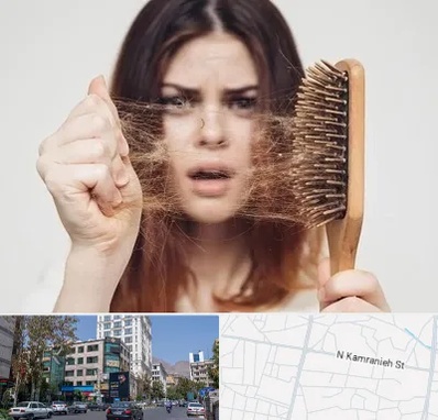 دکتر ریزش مو در کامرانیه