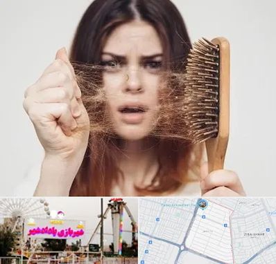 دکتر ریزش مو در پادادشهر اهواز