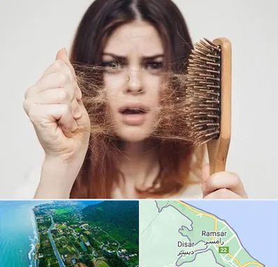 دکتر ریزش مو در رامسر