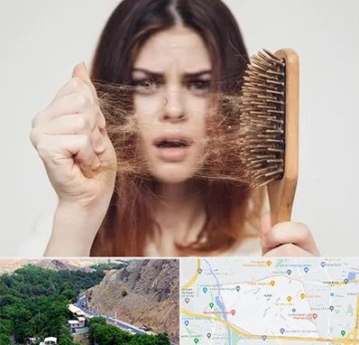 دکتر ریزش مو در کن 