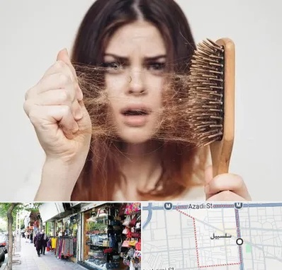 دکتر ریزش مو در سلسبیل