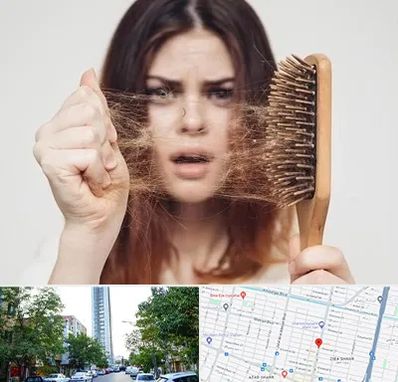 دکتر ریزش مو در امامت مشهد