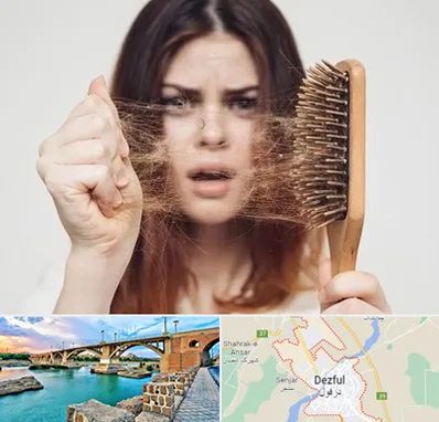 دکتر ریزش مو در دزفول