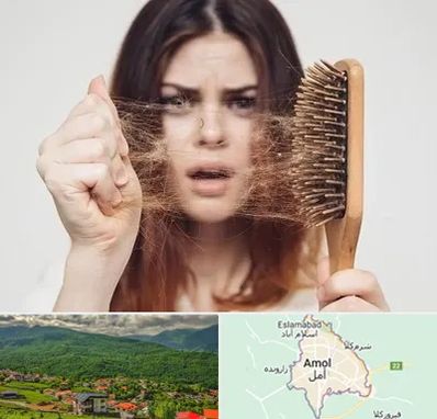 دکتر ریزش مو در آمل
