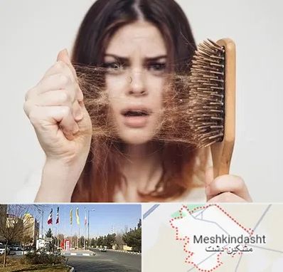 دکتر ریزش مو در مشکین دشت