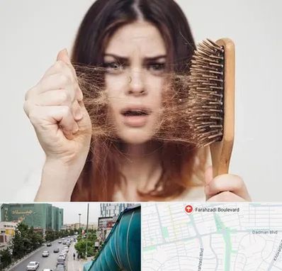 دکتر ریزش مو در بلوار فرحزادی