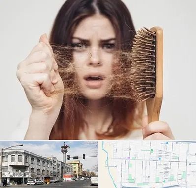 دکتر ریزش مو در 17شهریور