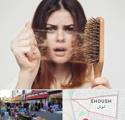 دکتر ریزش مو در شوش