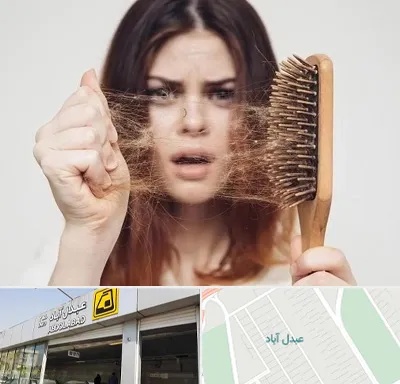 دکتر ریزش مو در عبدل آباد