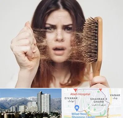 دکتر ریزش مو در شهرک غرب 