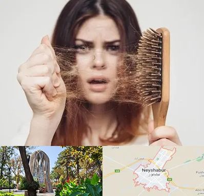 دکتر ریزش مو در نیشابور