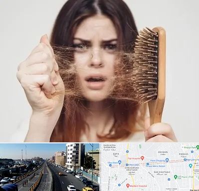 دکتر ریزش مو در پیروزی 