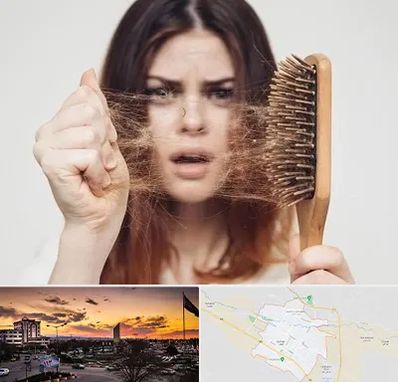 دکتر ریزش مو در قوچان