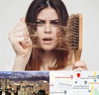 دکتر ریزش مو در جردن 