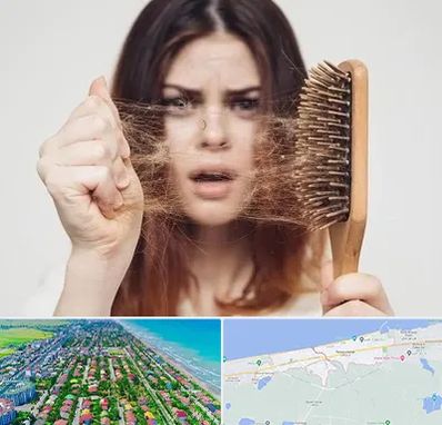 دکتر ریزش مو در فریدونکنار