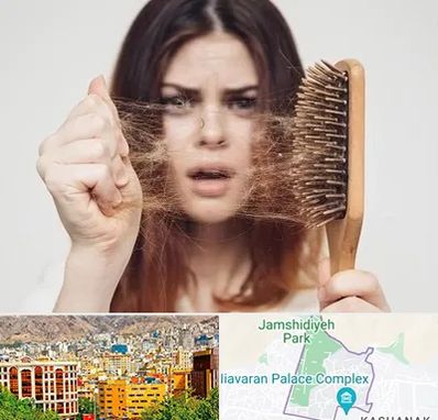 دکتر ریزش مو در نیاوران 