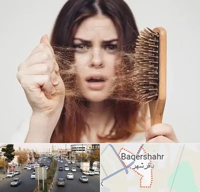 دکتر ریزش مو در باقرشهر