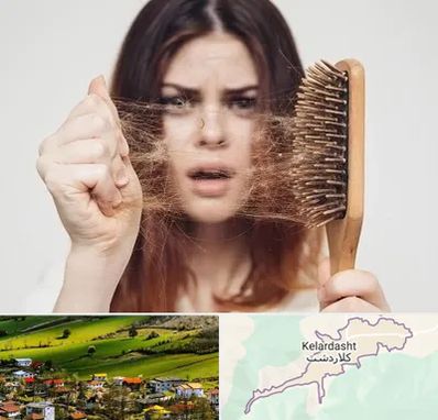 دکتر ریزش مو در کلاردشت