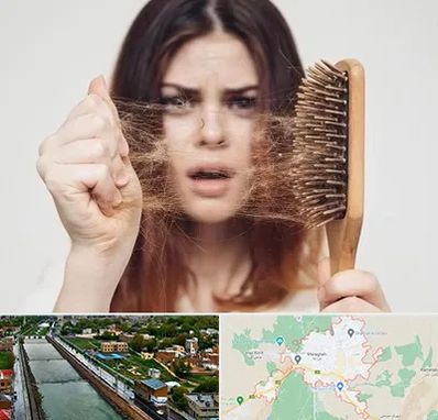 دکتر ریزش مو در مراغه