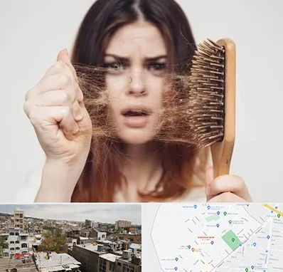 دکتر ریزش مو در شمیران نو