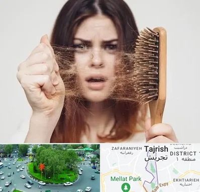 دکتر ریزش مو در تجریش 