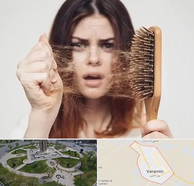 دکتر ریزش مو در ورامین
