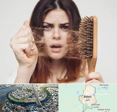 دکتر ریزش مو در بابل