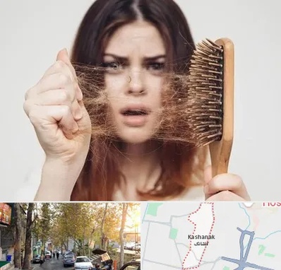 دکتر ریزش مو در کاشانک