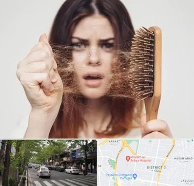 دکتر ریزش مو در ظفر 